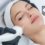 Bắn Laser Pico Giá Bao Nhiêu? Bảng Giá Điều Trị Chi Tiết Mới Nhất