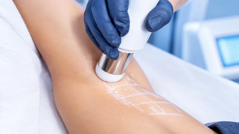 CFU Èlife còn hỗ trợ giảm tiết mồ hôi nách