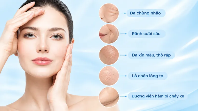 Laser Fotona 4D phù hợp người  gặp tình trạng lão hóa da, nếp nhăn, da kém đàn hồi