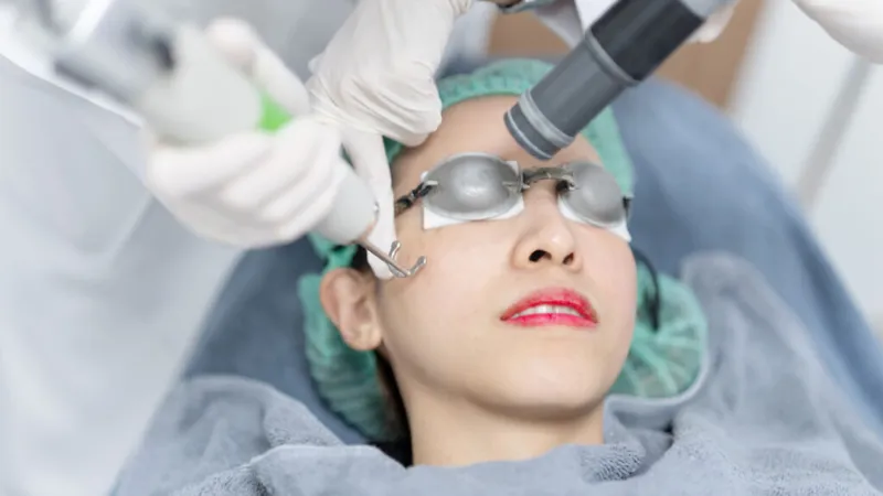 Laser Pico sử dụng xung laser siêu ngắn, hỗ trợ cải thiện sắc tố, sẹo mụn và trẻ hóa da