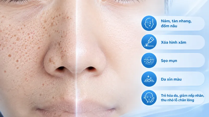 Laser pico phù với đa dạng tình trạng da