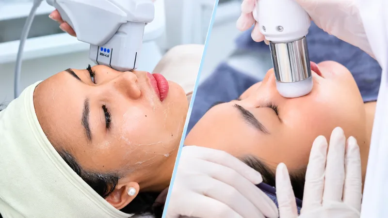 So Sánh CFU Và HIFU: Nên Chọn Công Nghệ Nào Cho Nâng Cơ Trẻ Hóa Da