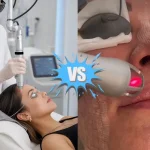 So Sánh Laser Pico Và Laser CO2 Khác Nhau Như Thế Nào?