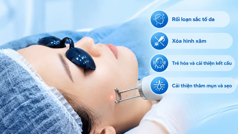 Laser Pico hỗ trợ cải thiện sắc tố, xóa xăm, trẻ hóa, thâm mụn và sẹo nông