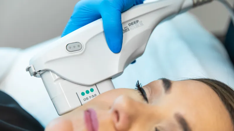 Ultherapy l&agrave; c&ocirc;ng nghệ n&acirc;ng cơ trẻ h&oacute;a da sử dụng s&oacute;ng si&ecirc;u &acirc;m hội tụ vi điểm