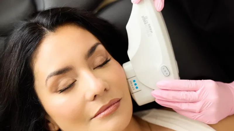 Thermage ph&ugrave; hợp khi da nhiều nếp nhăn, k&eacute;m săn chắc, mất đ&agrave;n hồi