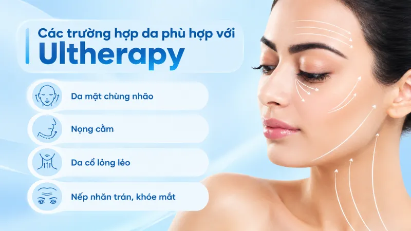 N&acirc;ng cơ trẻ h&oacute;a da Ultherapy ph&ugrave; hợp nhất với người c&oacute; l&agrave;n da ch&ugrave;ng nh&atilde;o, chảy xệ