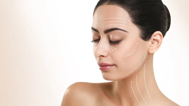 T&aacute;c động s&acirc;u lớp SMAS gi&uacute;p n&acirc;ng cơ mặt, thon gọn đường viền h&agrave;m v&agrave; cằm