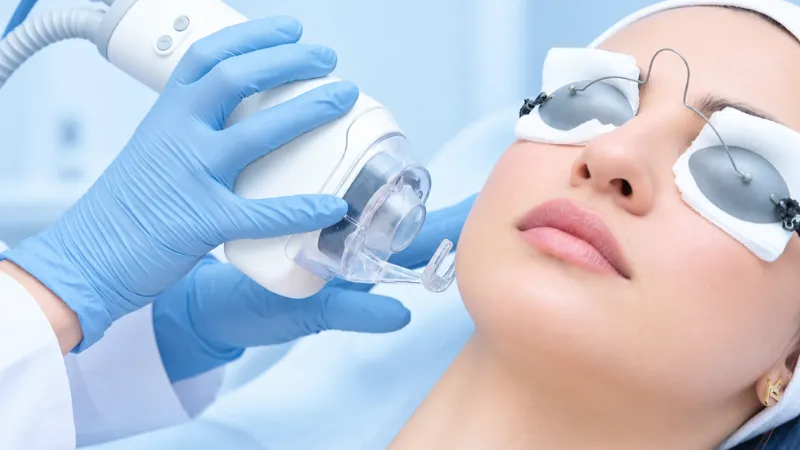 Laser CO2 Fractional Là Gì? Nguyên Lý, Công Dụng, Hiệu Quả Và Lưu Ý An Toàn