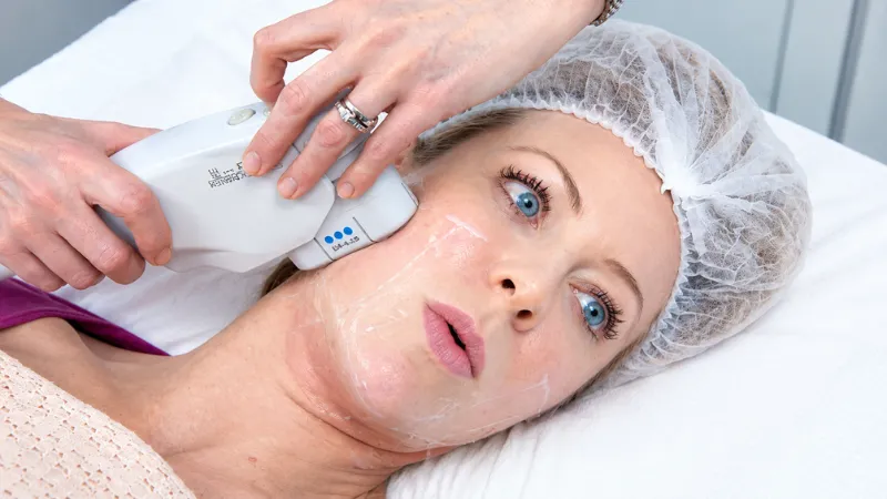 Ultherapy Có Đau Không? Giải Đáp Chi Tiết Và Lưu Ý Quan Trọng